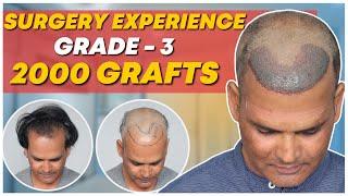 Hair Transplant in Indore | Best Results & Cost of Hair Transplant in Indore