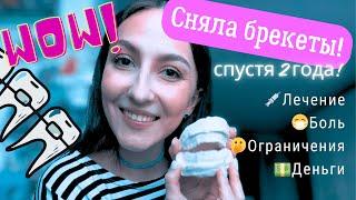 СПУСТЯ 2 ГОДА СНЯЛА БРЕКЕТЫ! Про лечение, боль и деньги!