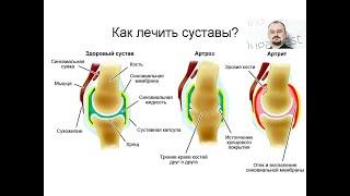 Как лечить суставы?