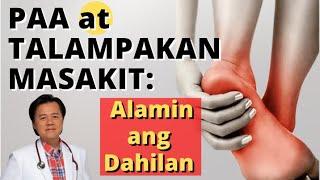 Paa at Talampakan Masakit: Alamin ang Dahilan - Payo ni Doc Willie Ong #1331