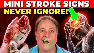 8 Signs of Mini Strokes in Elderly (Transient ischemic attack)