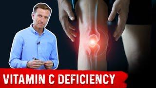 Could Your Joint Pain Be a Vitamin C Deficiency? – Dr.Berg