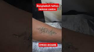 Bangladesh tattoo remove centre