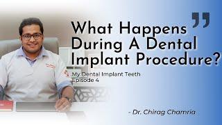 What Is Dental Implant Procedure? My Dental Implant Teeth Ep 4 | Dr Chirag Chamria