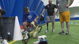 Houston teen surprised with new prosthetic leg at mobility clinic