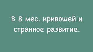 Кривошея и странности в развитии. 8 мес