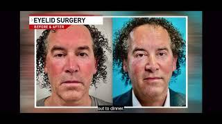 WKRC Exclusive -Dr Jon Mendelsohn Shares His Upper Eyelid Surgery Experience Before & After Results.