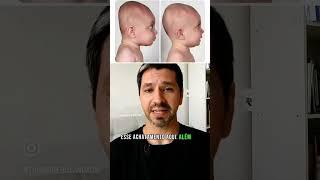 O bebê que fica só de barriga pra cima pode acontecer isso… 