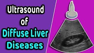 Ultrasound of diffuse liver diseases