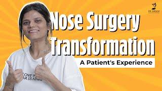 Rhinoplasty Surgery | Testimonial About Rhinoplasty Surgery | Dr. Sridevi