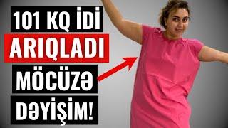 Azərbaycanlı qadın 101 KQ idi, ARIQLADI - Heç kəs onu tanıya bilmədi