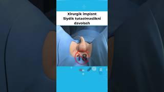 Siydik Tutaolmaslik Davosi #doctoruz #shortvideo #doctor #youtubeshorts #animation #shorts