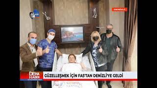 Güzelleşmek için Fas'tan Cerrahi Hastanesi'ne Geldi, Hayalleri Gerçekleşti