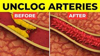 Top 5 Foods To Clean Arteries And Prevent Heart Attacks