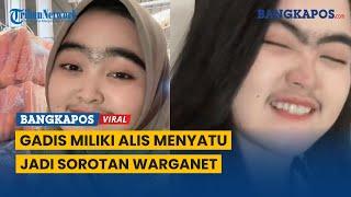 Gadis Miliki Alis Menyatu dan Kumis Lebat, Jadi Sorotan Warganet