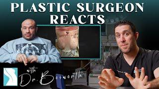 Dr. Mike Israetel Gets Plastic Surgery
