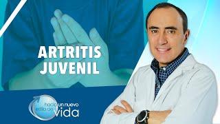 ARTRITIS JUVENIL - HACIA UN NUEVO ESTILO DE VIDA