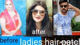 Big b hair solution mumbai