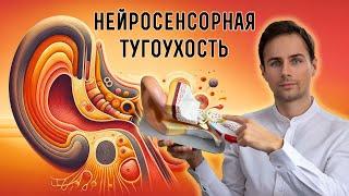 Самый частый тип снижения слуха | Сенсоневральная тугоухость. Диагностика, профилактика, лечение.