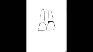 Root Surface caries