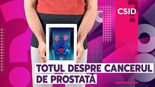 Cancerul de prostată: simptome, diagnostic, tratament