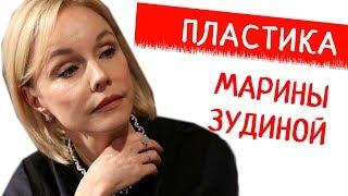 МАРИНА ЗУДИНА - жертва неудачной пластики?