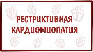 Рестриктивная кардиомиопатия — причины, симптомы, патогенез, диагностика, лечение