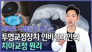 투명교정장치 정말 치아교정이 될까? #인비절라인 #치아교정