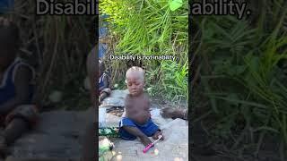 His dream is to walk #shorts #trending #viral #funny