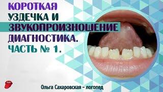 Короткая уздечка языка. Как влияет на произношение звуков? Диагностика  Часть № 1