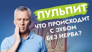 Пульпит. Что происходит с зубом без нерва?