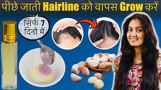 7 Days Challenge : गायब होती HAIRLINE को दोबारा उगाने के आसान तरीके | Grow Receding Hairline 100%️