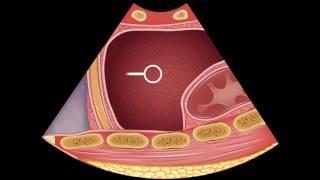 Introduction EFAST Focused Ultrasound Examination