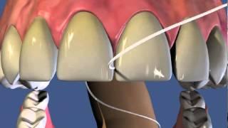 Гигиена   Зубная нить как использовать