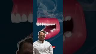 Что может случиться если не поставить имплант? #стоматолог #dentist #виниры #Сочи