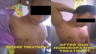 Homoeopathy Medical Science results; way of energy medicines