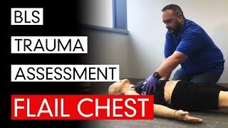 BLS Trauma Assessment - Flail Chest