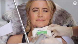 My Coolsculpting (Fat Freeze) Experience - Is it worth the money?