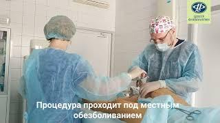 Как проходит ЭВЛК: лечение варикоза лазером в «Центре Флебологии»