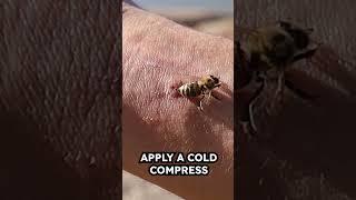 Bee sting treatment #bee #bees #beesting