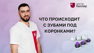 Что происходит с зубами под коронками?