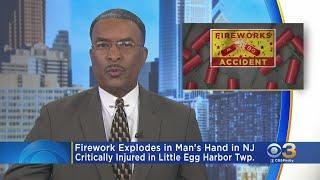 Little Egg Harbor Township Man Fighting For Life After Firework Explodes In His Hands