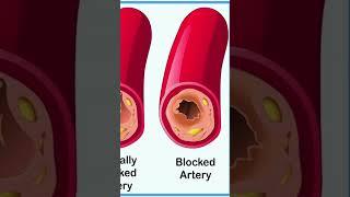Berberine vs. Metformin