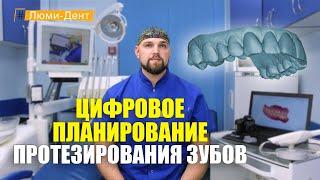 Протезирование зубов: Цифровое моделирование улыбки (Видео) Люми-Дент Киев