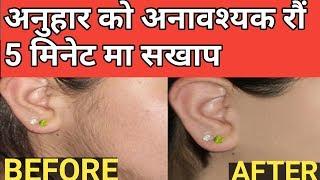 अनुहारको अनावश्यक रौ 5 मिनेटमा हटाउनुश सधैको लागी( how to remove facial hair at home in natural