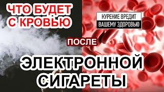 Влияние электронных сигарет на кровь человека