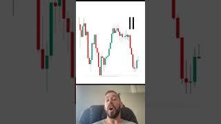 Test Your Candlestick Knowledge