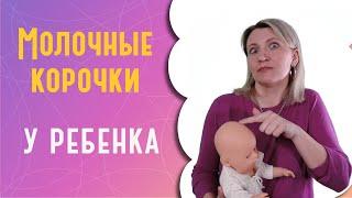 Молочные корочки у ребенка: что это и как удалить?