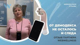 Как избавиться от демодекса с помощью Life Balance Contact: отзыв партнера WebWellness