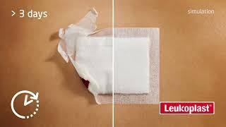 Leukoplast® Hypafix® Wide Area Fixation
